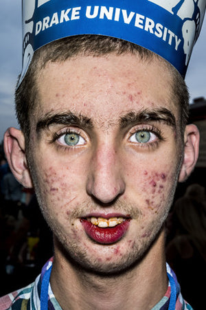FACE