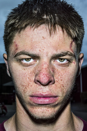 FACE